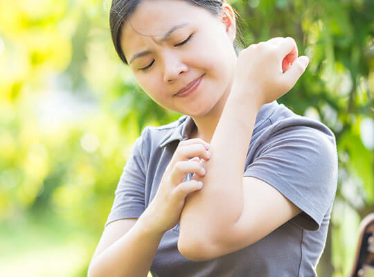 A young woman scratching her arm outside from a mosquito bite.